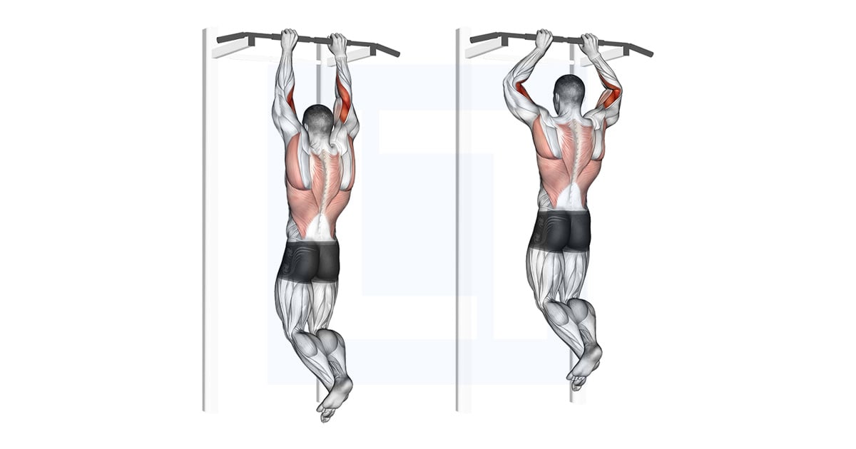 Brachialis Tractions